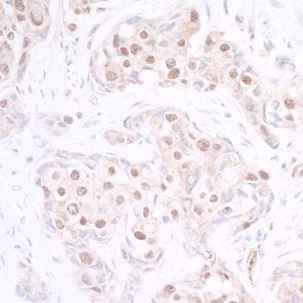 Polyclonal Rabbit anti-Human EP300 / p300 Antibody (aa950-1000, IHC, WB)