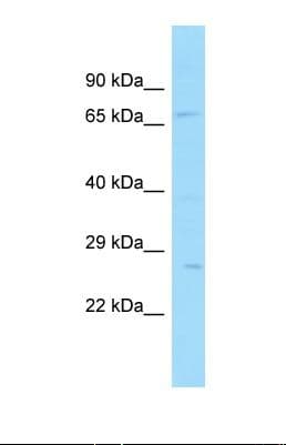 Polyclonal Rabbit anti-Human SNX33 Antibody (aa482-531, WB)
