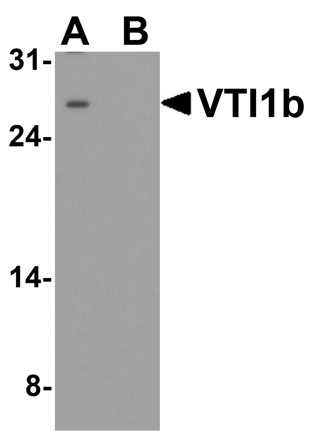IHC-plus™ VTI1B Antibody