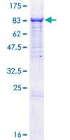 Human CEP104 Protein (Recombinant GST)