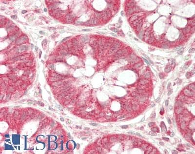 IHC-plus™ Polyclonal Rabbit anti-Human PDSS2 / DLP1 Antibody (aa88-351, IHC, WB)