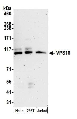 VPS18 Antibody (aa900-950)