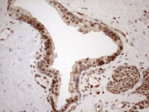 MGMT Antibody (clone OTI10H9)