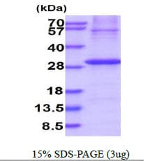 Human KLK2 / Kallikrein 2 Protein (Recombinant His)