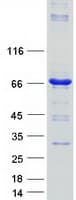 Human HAL / Histidine Ammonium Lyase Protein (Recombinant Myc-DDK (Flag))