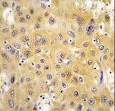 TP / Thymidine Phosphorylase Antibody (aa318-345)