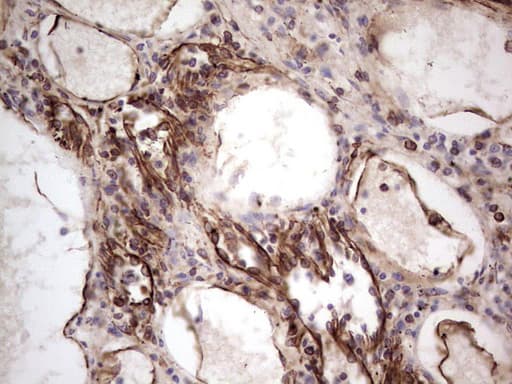 Peripherin Antibody (clone OTI1E10)
