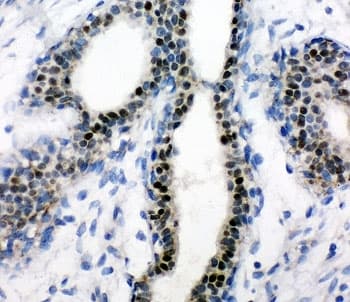 Polyclonal Rabbit anti-Human Estrogen Receptor Antibody (aa425-595, IHC, WB)