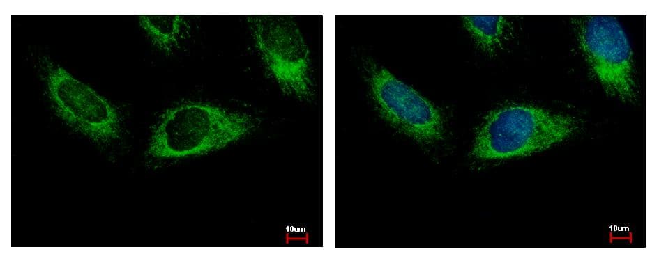 HPS3 Antibody (aa942-1004)