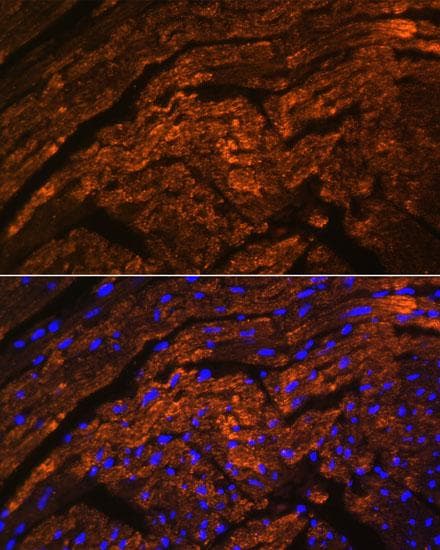 Polyclonal Rabbit anti-Human TTN / Titin Antibody (IF)