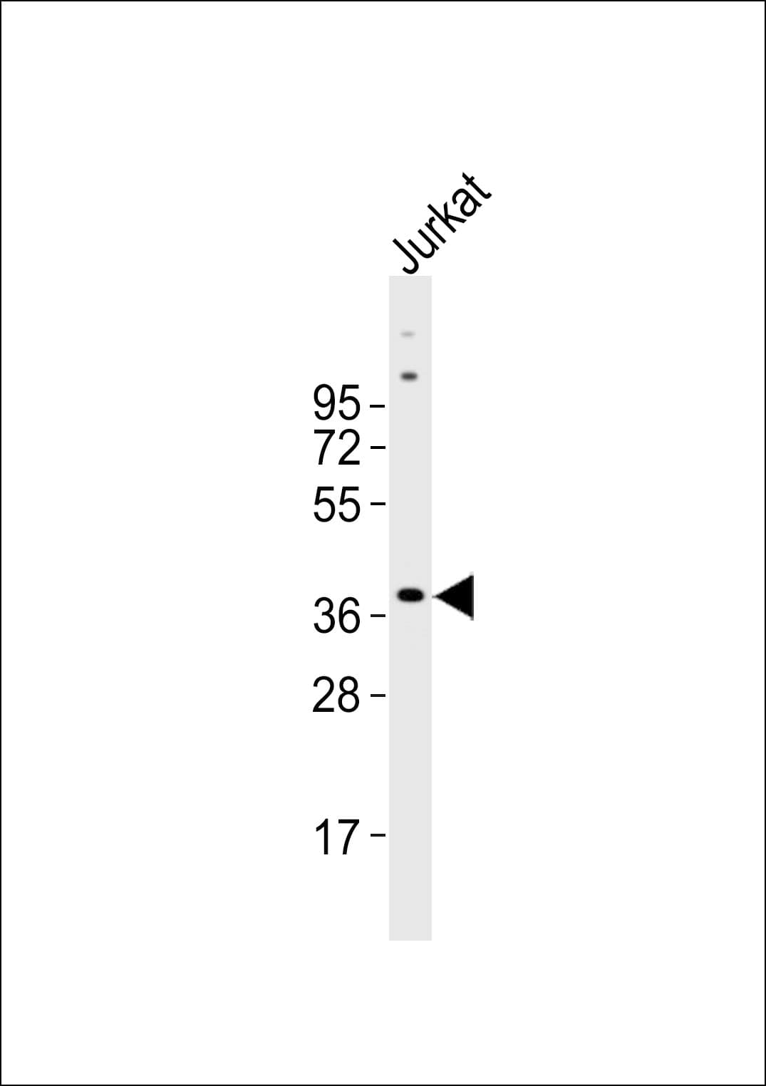 RNF113B Antibody