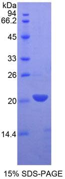 Rat LECT2 Protein (Recombinant His-T7)