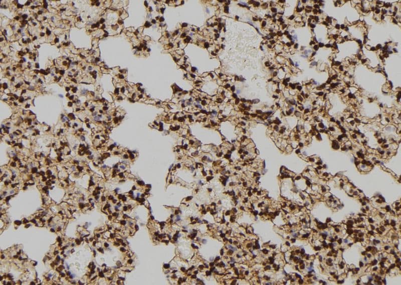 TPT1 / TCTP Antibody