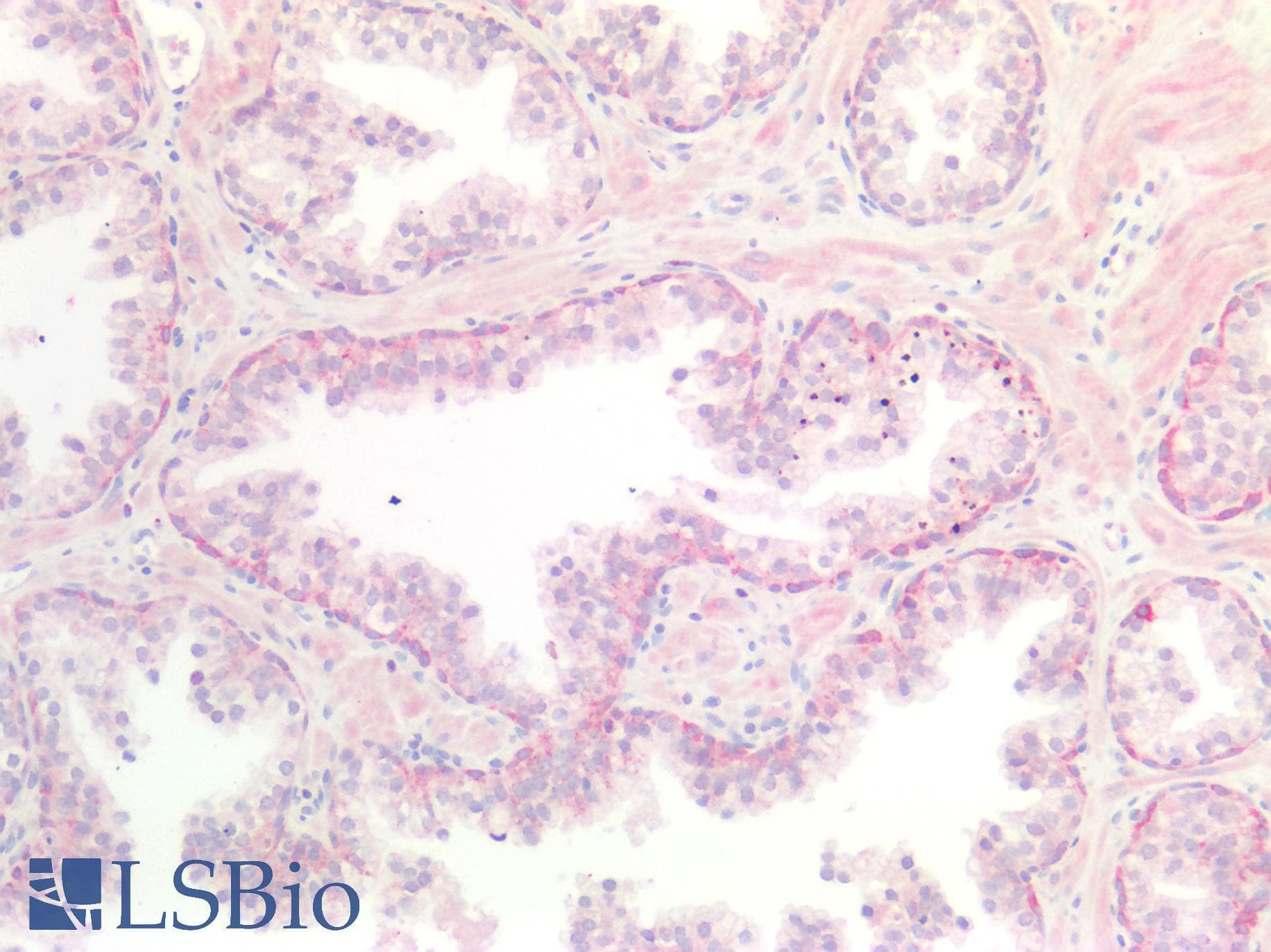 IHC-plus™ KRT7 / CK7 / Cytokeratin 7 Antibody