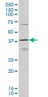 HOXD11 Antibody (clone 6C8)