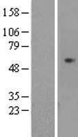 CDCA7L Protein (Over-Expression Lysate Myc-DDK (Flag))