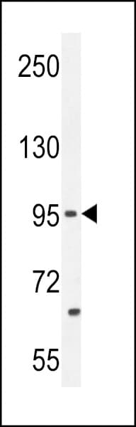 PCDH20 Antibody (aa445-472)
