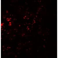 Polyclonal Rabbit anti-Human CCR7 Antibody (IHC, IF, WB)