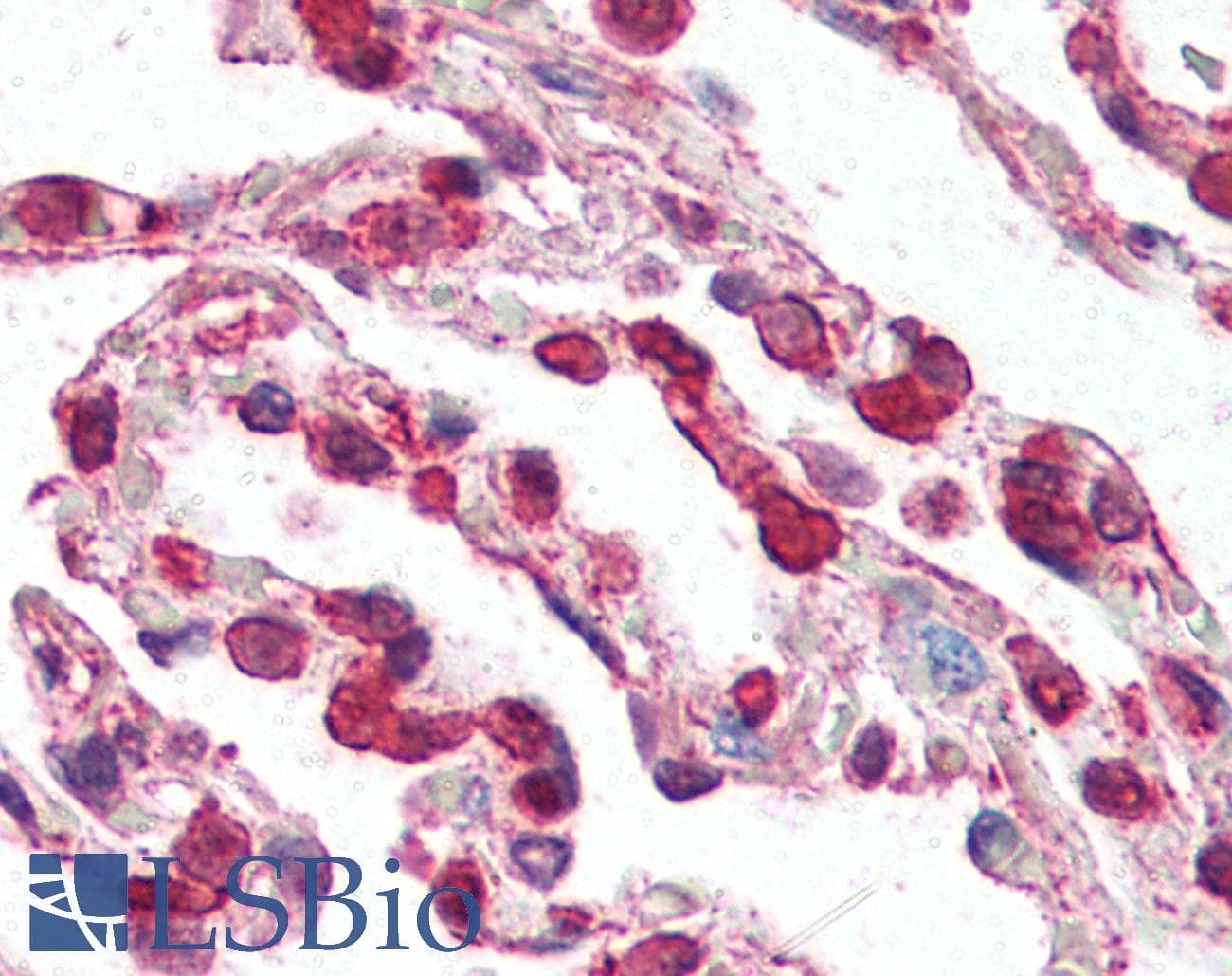 IHC-plus™ CCR3 Antibody