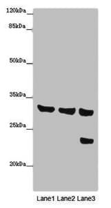 SLC25A10 / DIC Antibody