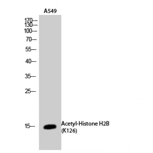 Polyclonal Rabbit anti-Human Histone H2B Antibody (acetylation site of K126., WB)