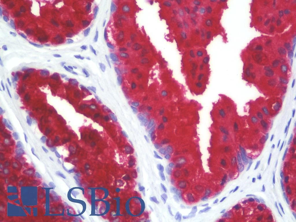 IHC-plus™ Monoclonal Mouse anti-Human KRT18 / CK18 / Cytokeratin 18 Antibody (clone C-04, Biotin, IHC, WB)