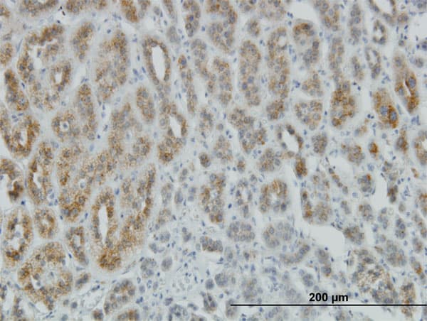 Monoclonal Mouse anti-Human ACLP / AEBP1 Antibody (clone 1D2, IHC, WB)