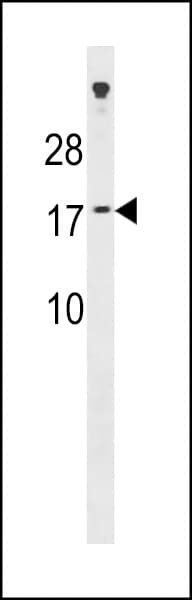 Polyclonal Rabbit anti-Human SSX7 Antibody (aa1-30, WB)