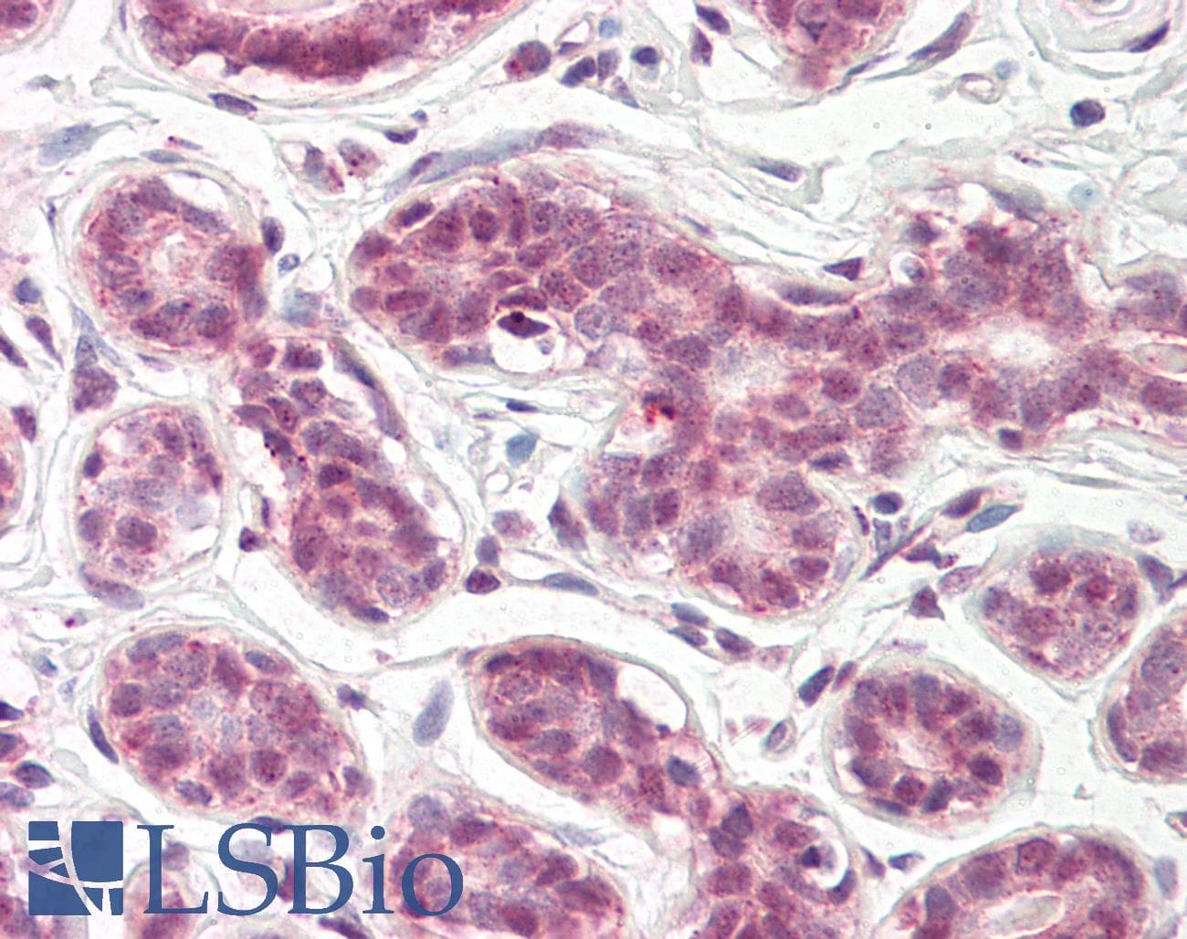 IHC-plus™ NUCKS1 Antibody (aa28-77)
