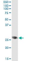 Monoclonal Mouse anti-Human FAM3B Antibody (clone 1E7, IHC, WB)