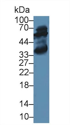 GPT / Alanine Transaminase Antibody (aa147-263, APC, Cy7)