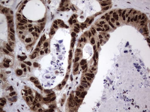 DDX56 Antibody (aa323-547, clone UMAB152)