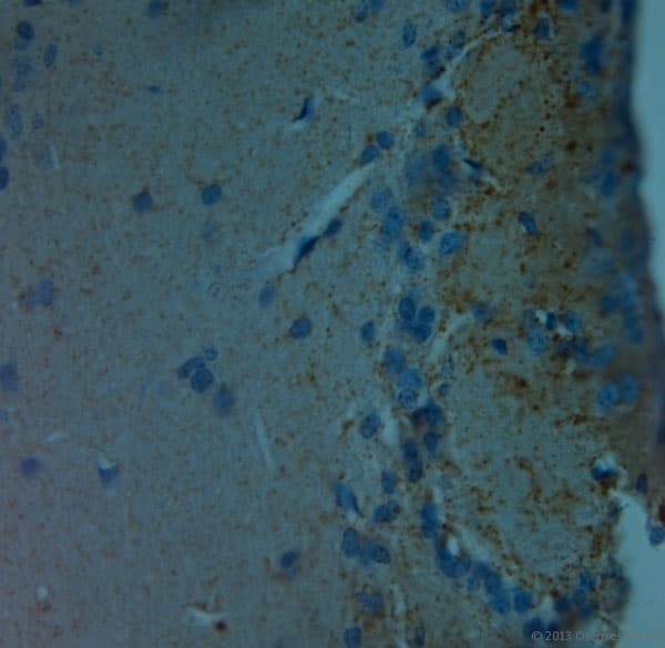 Polyclonal Rabbit anti-Rat GRIN3A / NR3A Antibody (aa1091-1135, IHC)