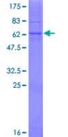 Human TMEM231 Protein (Recombinant GST)