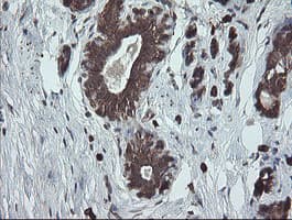 Monoclonal Mouse anti-Human UBE2J1 Antibody (clone OTI3C11, IHC, WB)