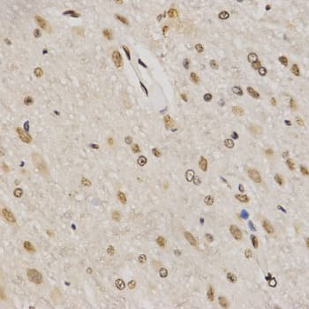 Histone H3 Antibody (Tri-Methyl-Lys79)