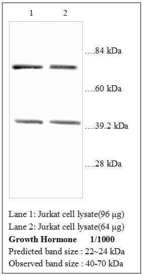 GH / Growth Hormone Antibody