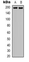 TOP2A / Topoisomerase II Alpha Antibody (C-Terminus)
