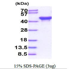 E. coli ackA Protein (Recombinant His)
