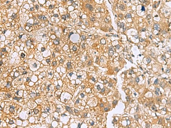MRPL22 Antibody
