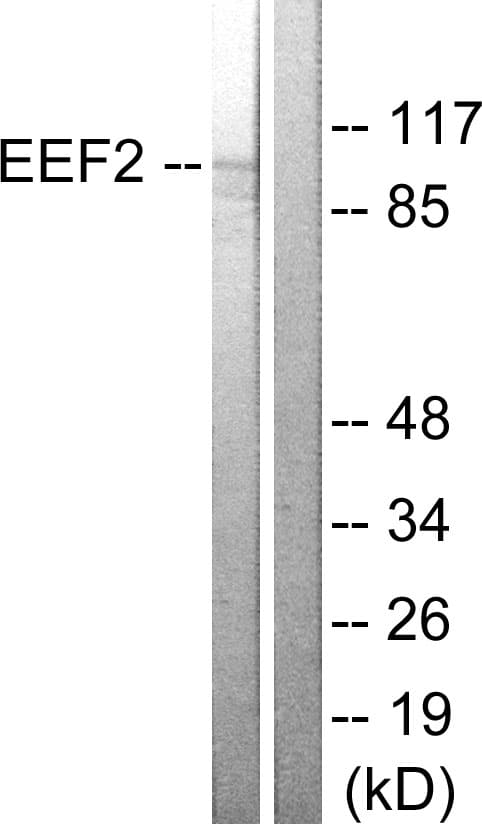 IHC-plus™ EEF2 / Elongation Factor 2 Antibody (aa31-80)