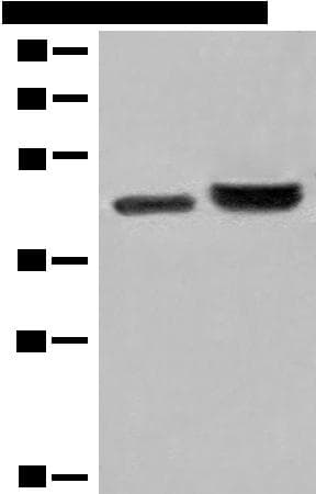INPP1 Antibody