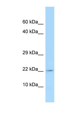 TSLP Antibody (aa89-138)