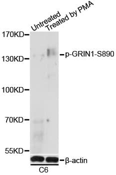 GRIN1 / NMDAR1 Antibody (phospho-Ser890)