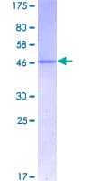 Human ANK1 / Ankyrin Protein (Recombinant GST)