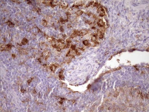 Monoclonal Mouse anti-Human CPM / Carboxypeptidase M Antibody (clone OTI1F8, aa124-423, IHC, WB)