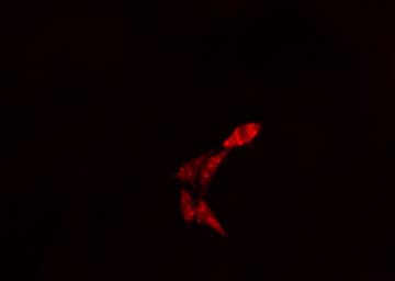 LBC / AKAP13 Antibody
