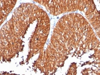 HSPD1 / HSP60 Antibody (clone SPM253)