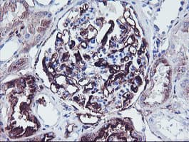 SCHIP1 Antibody (clone OTI1C8)