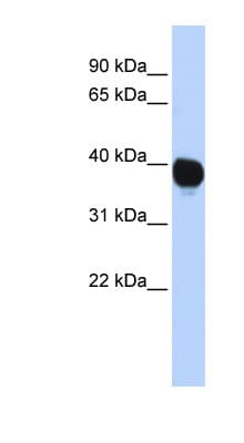 Polyclonal Rabbit anti-Human TPST2 Antibody (aa216-265, WB)